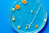 Microbe colonies on a petri dish