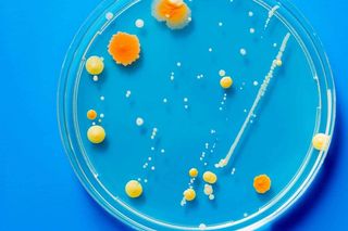 Microbe colonies on a petri dish