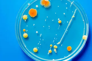 Microbe colonies on a petri dish