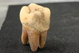 human tooth from ancient Japan