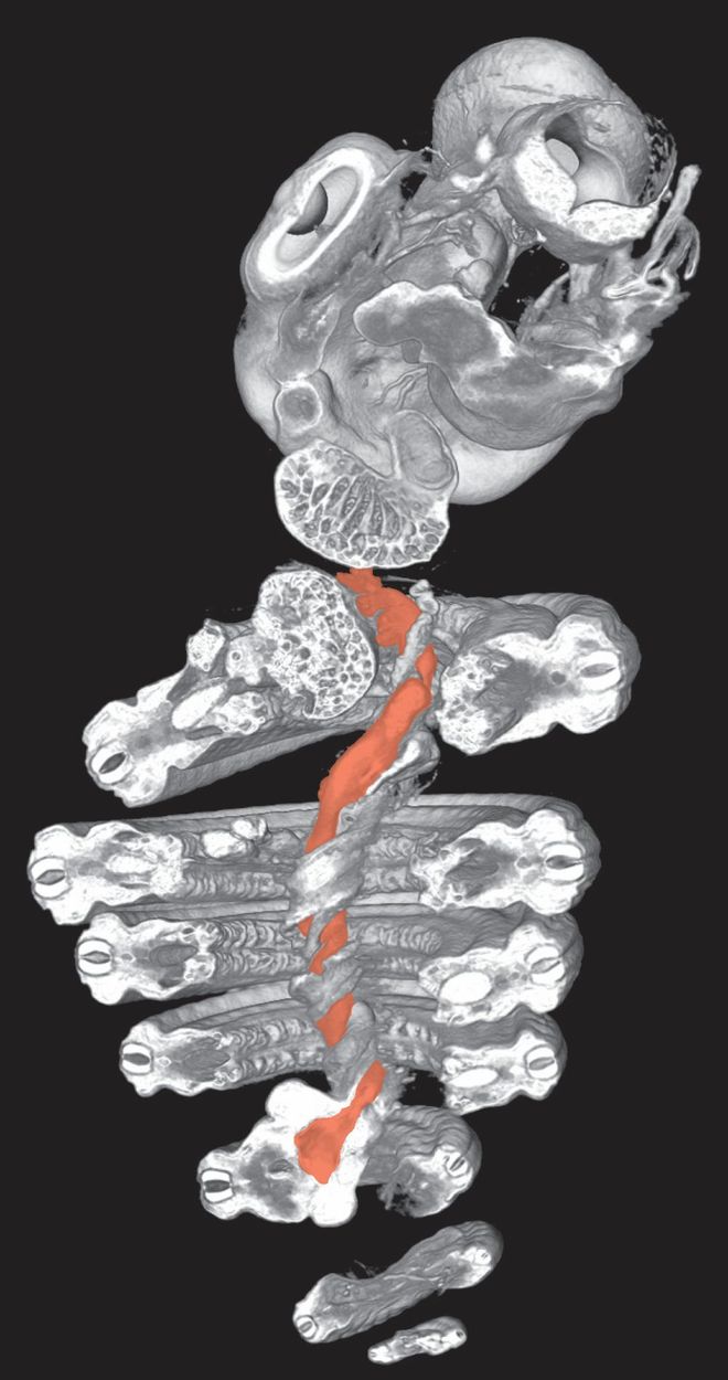 CT scan of a snake embryo showing the gut