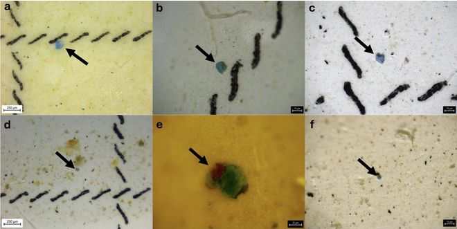 close up images of microplastics in lungs