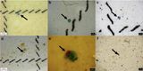 microplastics in lungs t