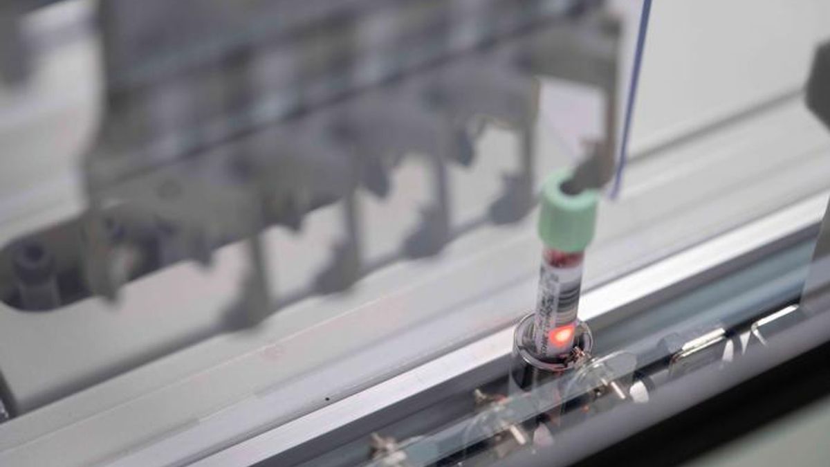 New Blood Test Could Catch Pancreatic Cancer at Its Earliest Stages, Helping Fight the "Silent Killer" 
