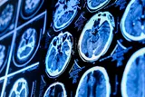 close up of a brain scan 