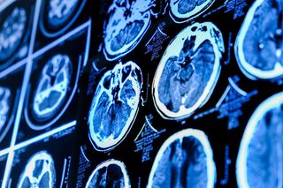 close up of a brain scan 