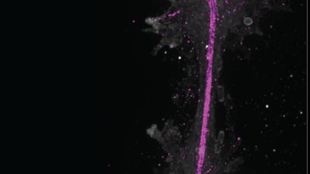 Newly Discovered Fire Amoeba Survives in Water at 158 Degrees Fahrenheit, Breaking Previous Records