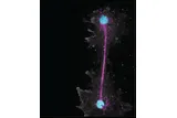 close up of fire amoeba organism 
