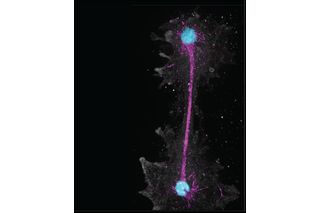 close up of fire amoeba organism