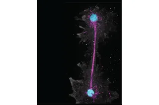 close up of fire amoeba organism 
