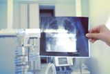 California May Ban Quartz Countertops Over Risk of Incurable Lung Disease in Workers