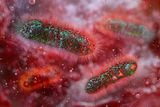 A Diarrhea-Causing Bacterium Spread Through Sex is Resisting Five Common Antibiotics&nbsp;