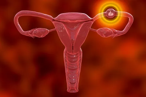 Ectopic Pregnancy in the fallopian tube 