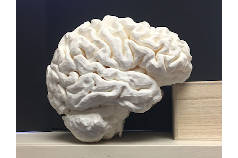3d printed brain model