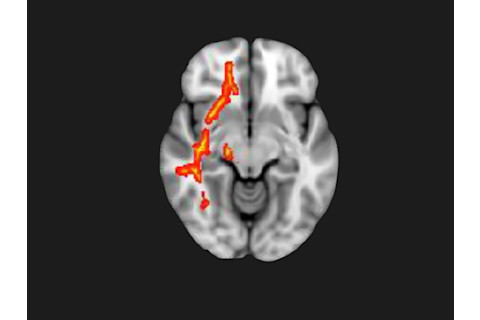 brain-scan.jpg?mw=900&mh=600