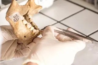 Researcher Examines Teeth 