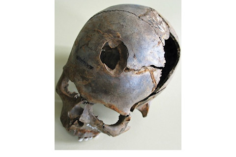 3500 year old skull