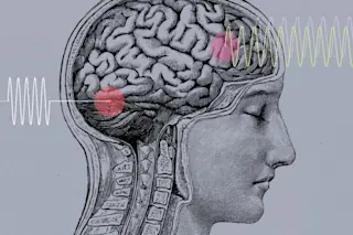 sonogenetics