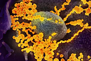 SARS CoV-2 (the COVID-19 virus) emerges from the surface of a cell cultured in the lab. (Credit: NIAID/NIH)