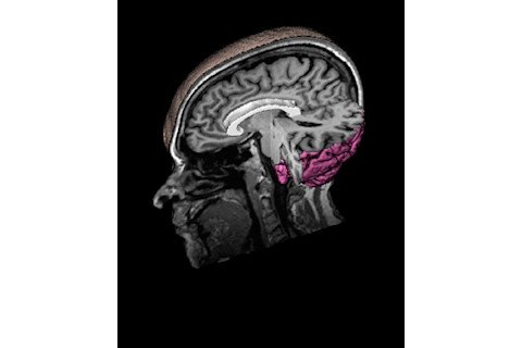 grandin-left-temporal-lobe