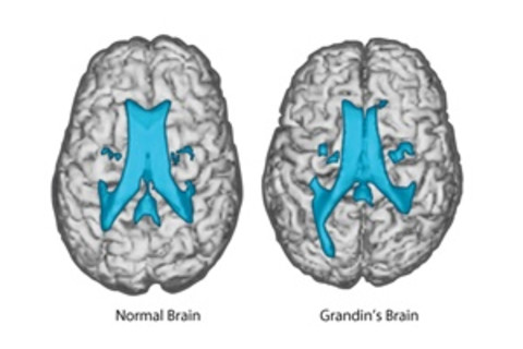 grandin-normal-brains