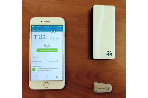 Bigfoot Biomedical artificial pancreas
