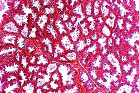 breast tissue