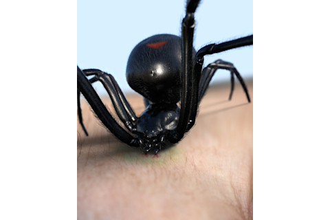 Black Widow spider stinging