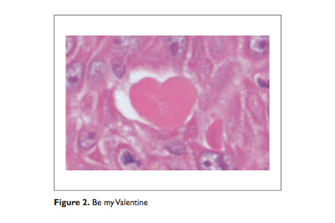 valentines21.png
